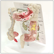 Medical Human Anatomical Intestine Model