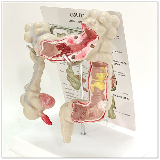 Medical Human Anatomical Intestine Model